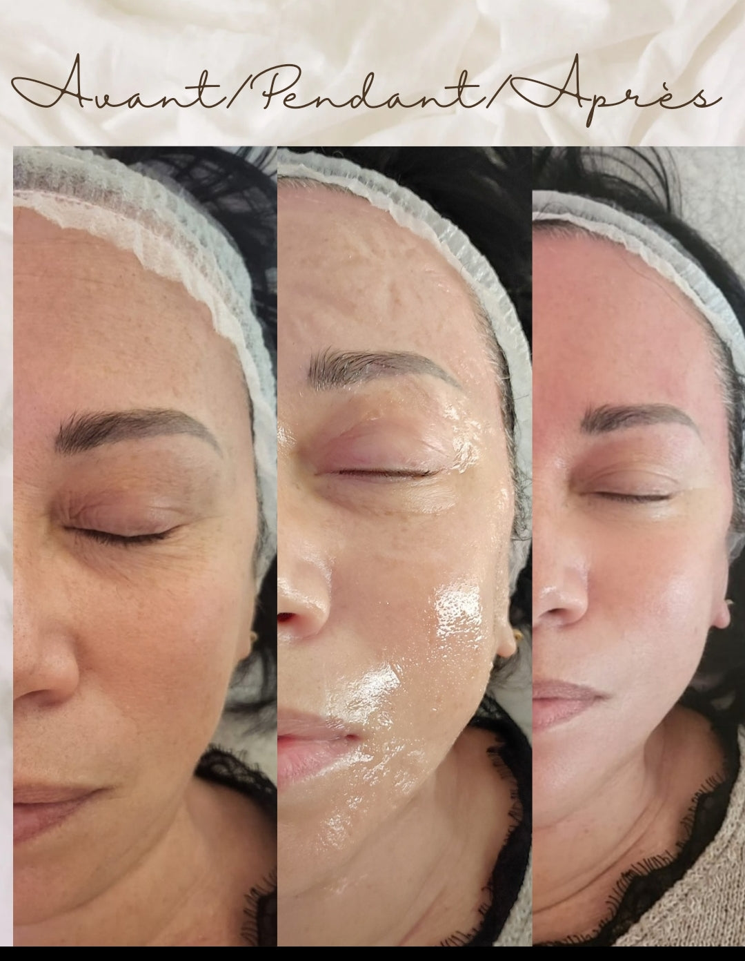 Masque visio contour + Lifting coréen